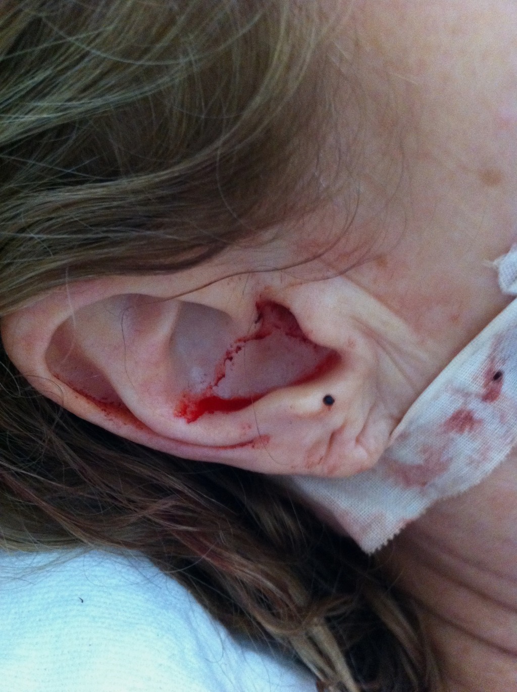 2011/05(May)/My Brain Injury Recovery/1024x768_2011-05-15-Janeen's TBI-07.jpg